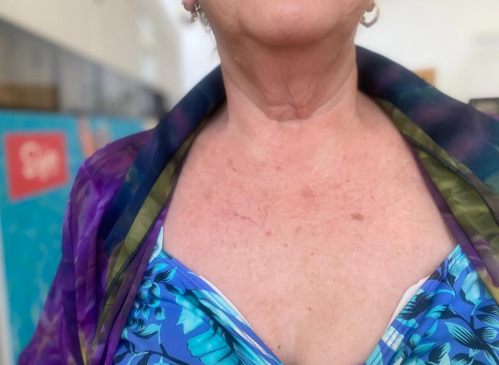 ⁦BOTO-V באחריות ישירות מהמיפעל. משחה למתיחת צוואר וחזה, ומעל גיל 50: לכל עור הפנים, זרועות מדולדלות, ישבן, בטן⁩ – תמונה ⁦3⁩