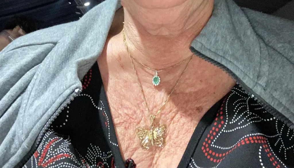 ⁦BOTO-V באחריות ישירות מהמיפעל. משחה למתיחת צוואר וחזה, ומעל גיל 50: לכל עור הפנים, זרועות מדולדלות, ישבן, בטן⁩ – תמונה ⁦2⁩